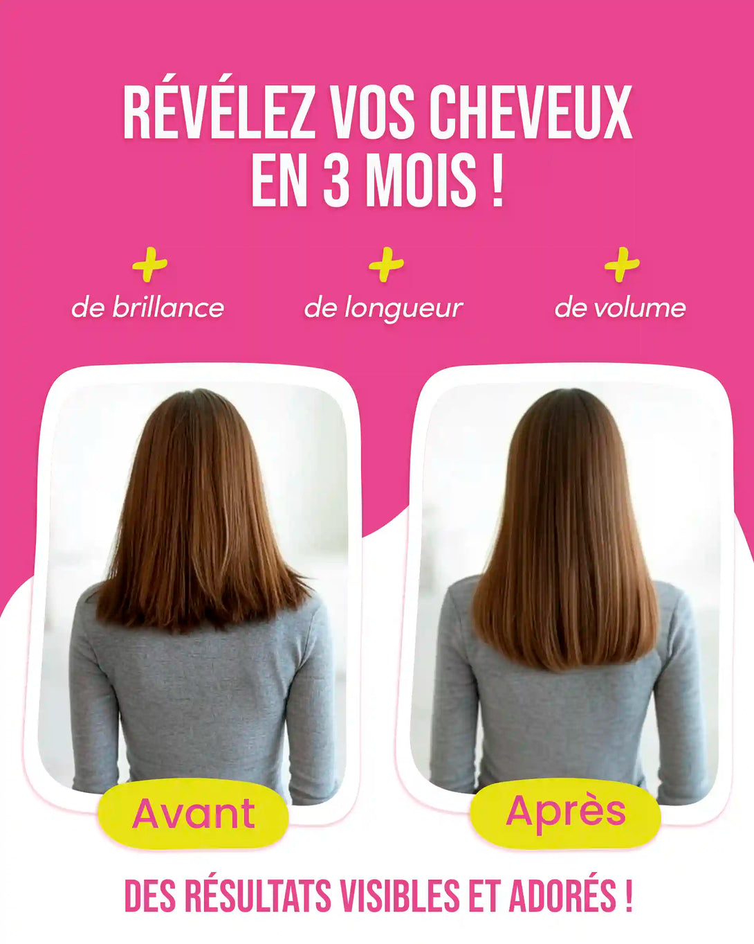 Complément cheveux avec 20 000 % de biotine Myriam•K Paris® – les gummies les plus dosées du marché