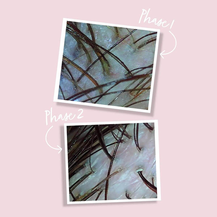 SCALP HUILE DETOXIFIANTE - Myriam•K Paris®